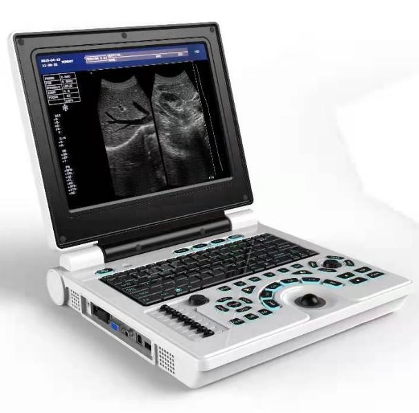 Córas Diagnóiseacha Ultrasonach Doppler Dath