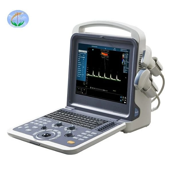 Díol Te 2d Scanóir Ultrafhuaime Dath Doppler Medical Inaistrithe Usg